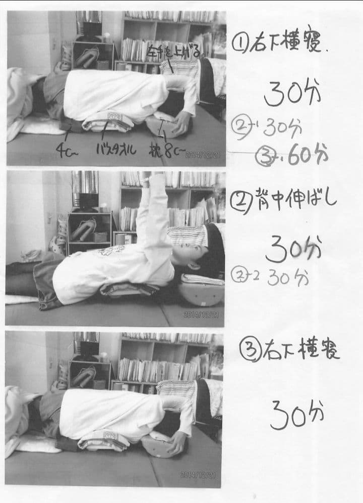 側弯症改善器具 木型 大塚整体