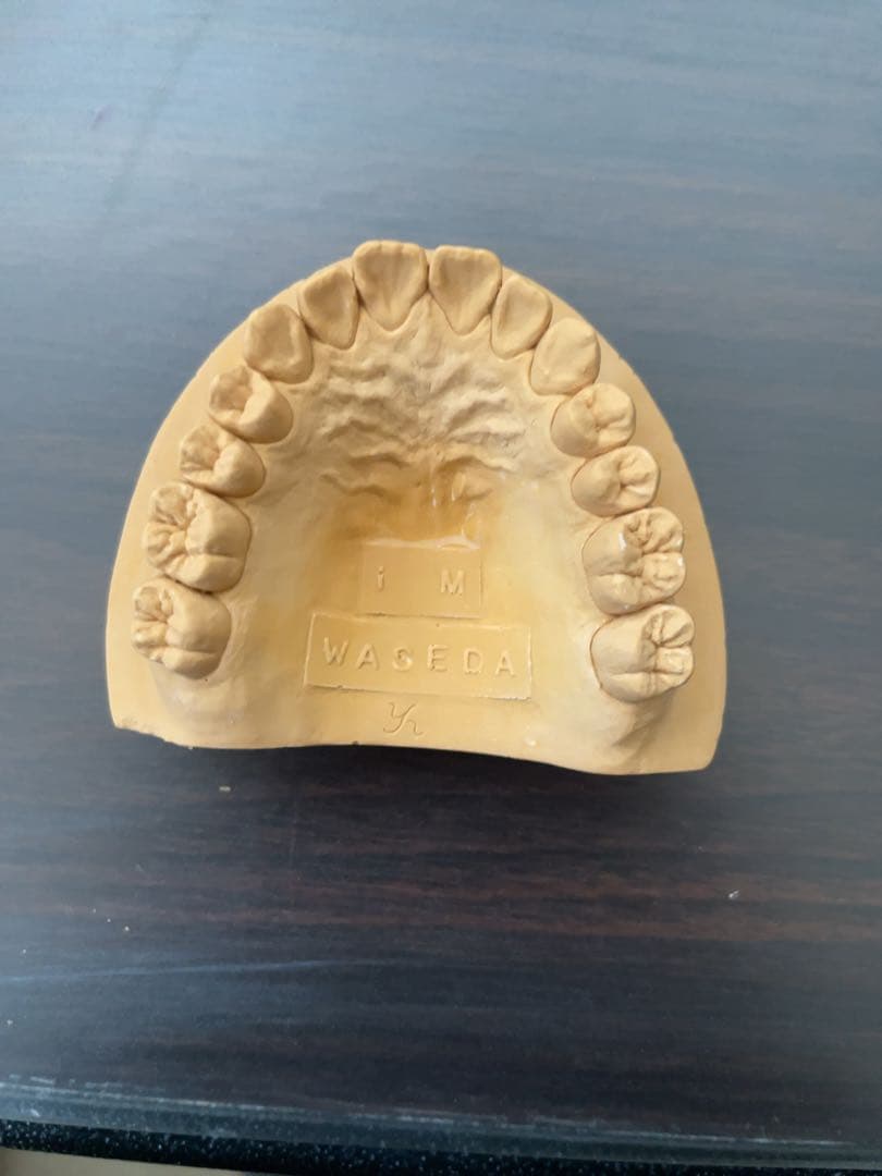 歯科技工　ワセトレ難波氏のサンプル模型です！