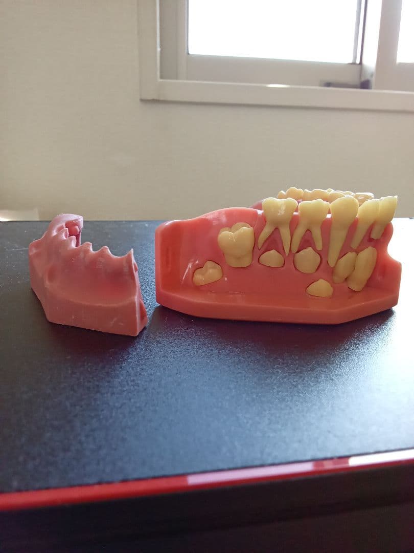 乳歯永久歯交換期模型、永久歯歯列模型