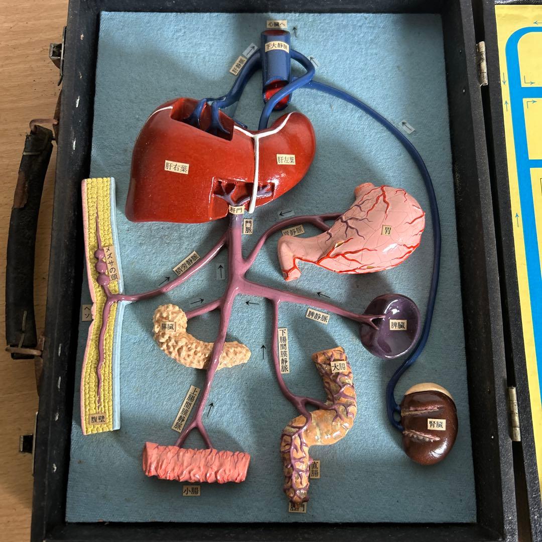 超レア　門脈系模型