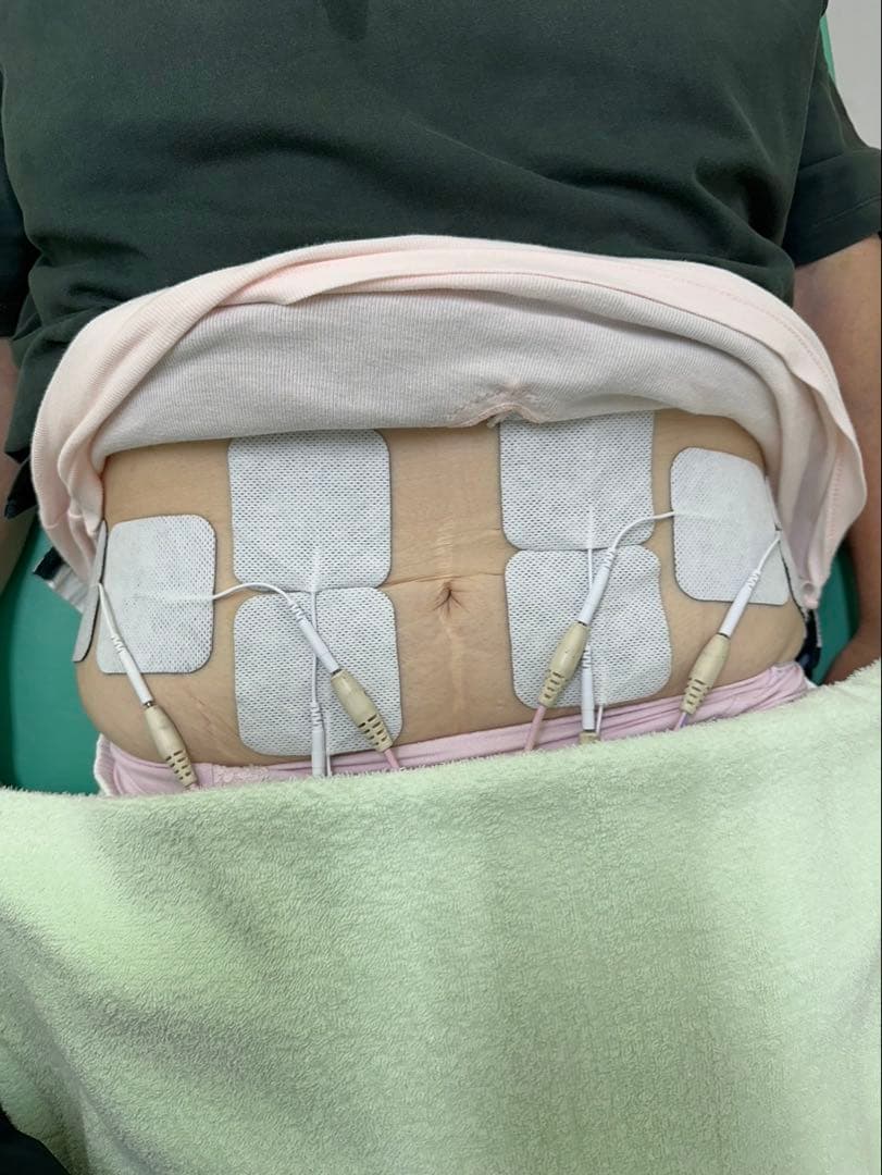 EMS粘着パッド40枚　整骨院楽トレ　バイトレJOYトレEMSパット 電極パッド